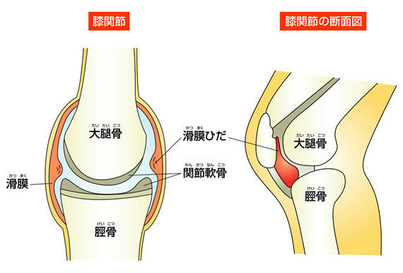 症状 膝 たまる に が 水 膝に水が溜まる原因と症状…治療法や手術後のリハビリ方法